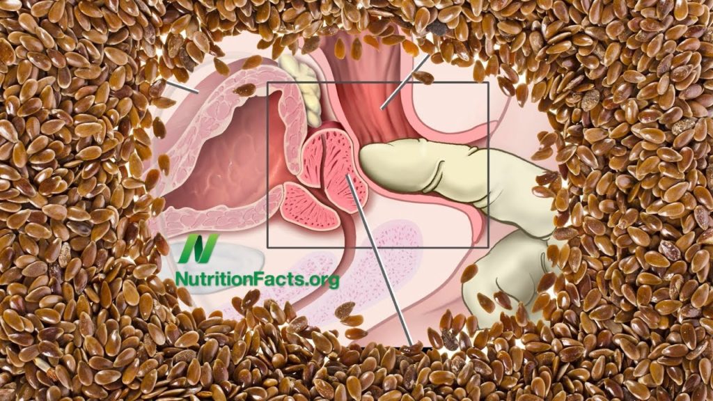 Flaxseed vs. Prostate Cancer